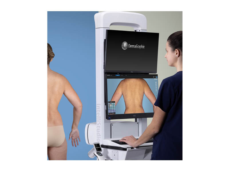 Mole Mapping generates £2,600 donation to Cancer Relief Mole Mapping generates £2,600 donation to Cancer Relief Image